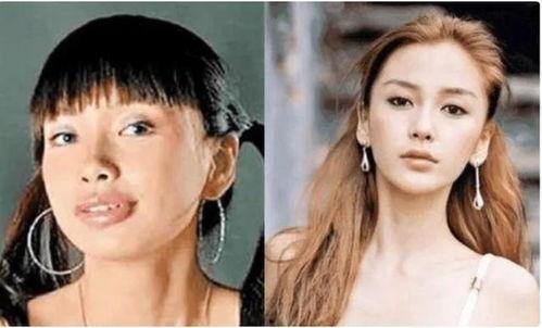 整过容的明星有谁,揭秘那些曾经整过容的璀璨身影